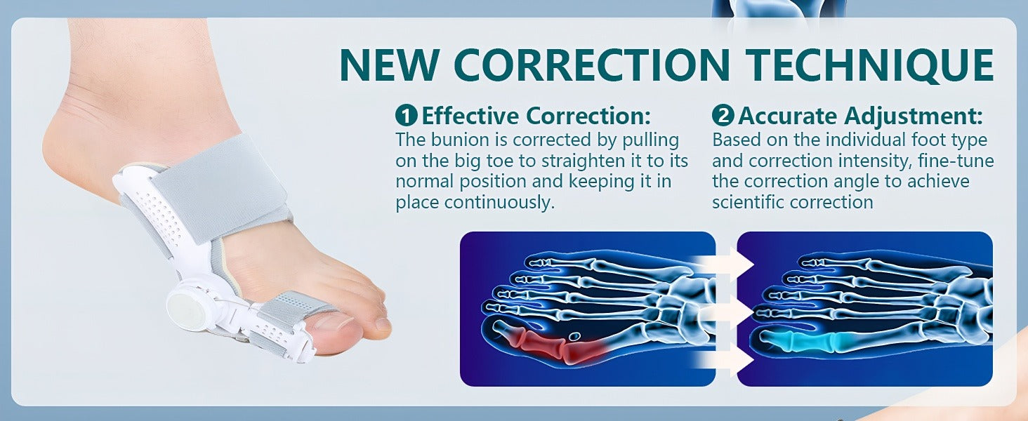 Adjustable Bunion Corrector for Women & Men | Big Toe Alignment Support