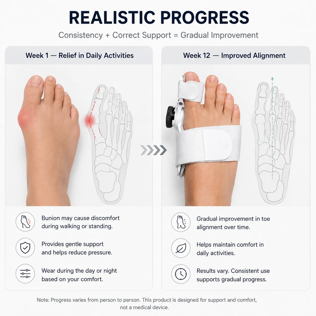 Yun & Rituals Bunion Corrector